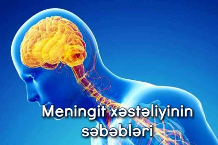 Meningit xəstəliyinin səbəbləri