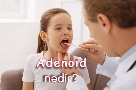Adenoid (burun əti) nədir? Adenoid əməliyyatı necə olur?