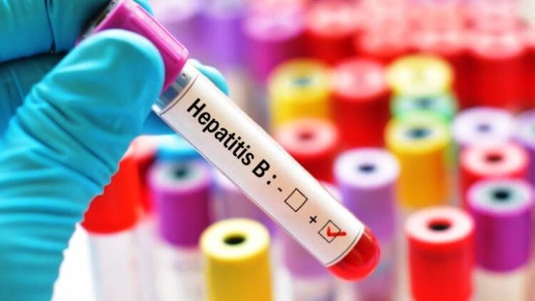Hepatit B üçün ümumi risk faktorları