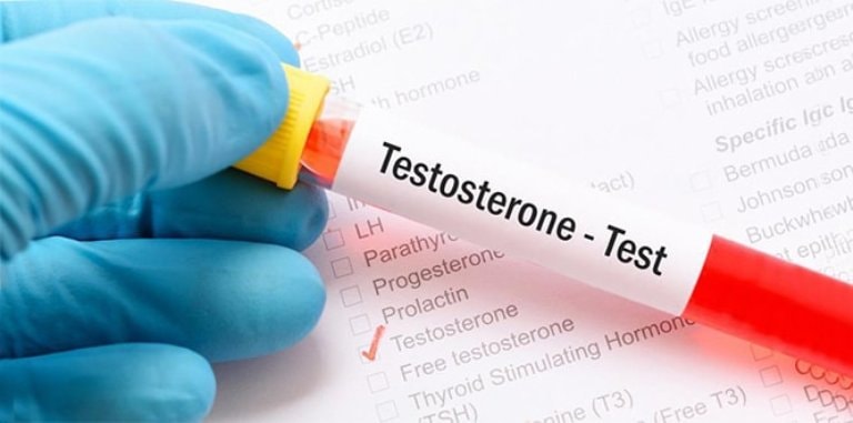 Testosteron hormonu testi